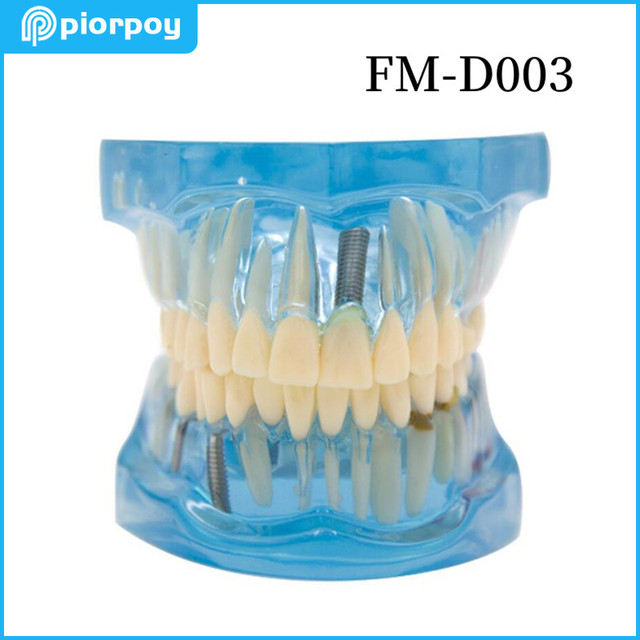 Dental Education Practice Model Removable Standard Teeth Mold Dentistry  Demonstration Dentista Teaching Student Training Tools - AliExpress